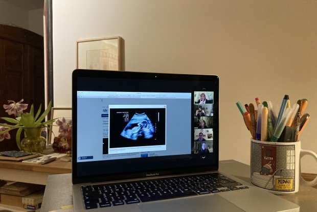Ein Laptop, auf dem Bildschirm sieht man ein Ultraschallfoto.