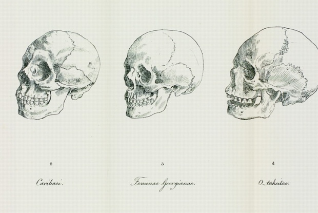 Drei gezeichnete Schädel mit Beschriftung darunter
