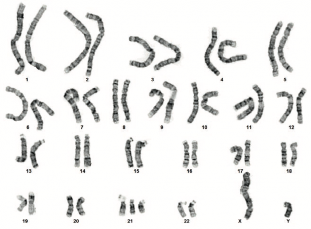 Chromosomen sind verschieden große Strukturen mit unterschiedlichen Ringelmustern. Hier sind sie in Paaren der Größe nach sortiert.