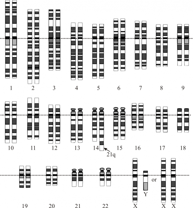 Eine Schamtische Zeichnung von Chromosomen. 2 Chromosomen sind dabei miteinander verschmolzen.